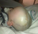 Barrett Sturgill 3 Survivor 060115