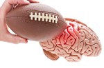 football-brain-injury