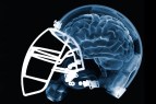 Brain in Helmet