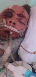 bartholomew-wayne-nathaniel-survivor-hospital