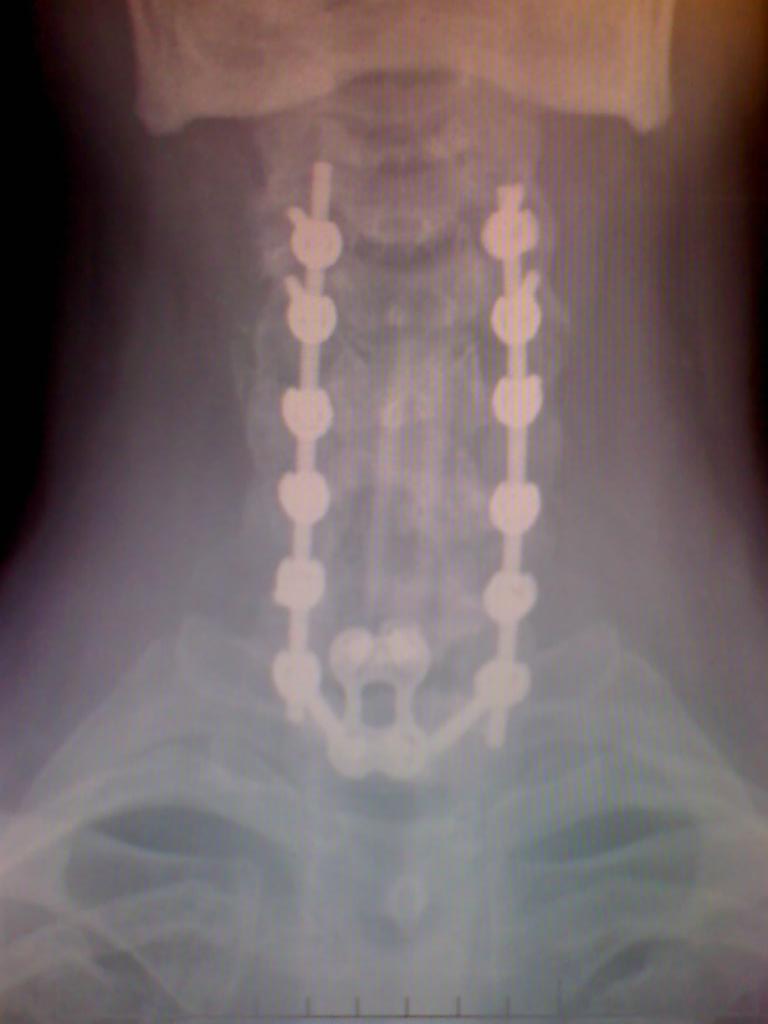 13559143_10209433746178751_4503340091034294199_o