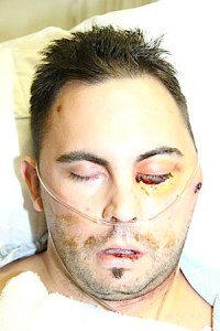 18 Jim Ledgewood 071518 f29335616