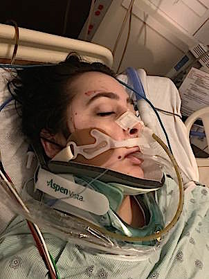 Jordan Fallert Survivor